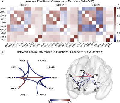 Violent Behavior Is Associated With Emotion Salience Network Dysconnectivity in Schizophrenia